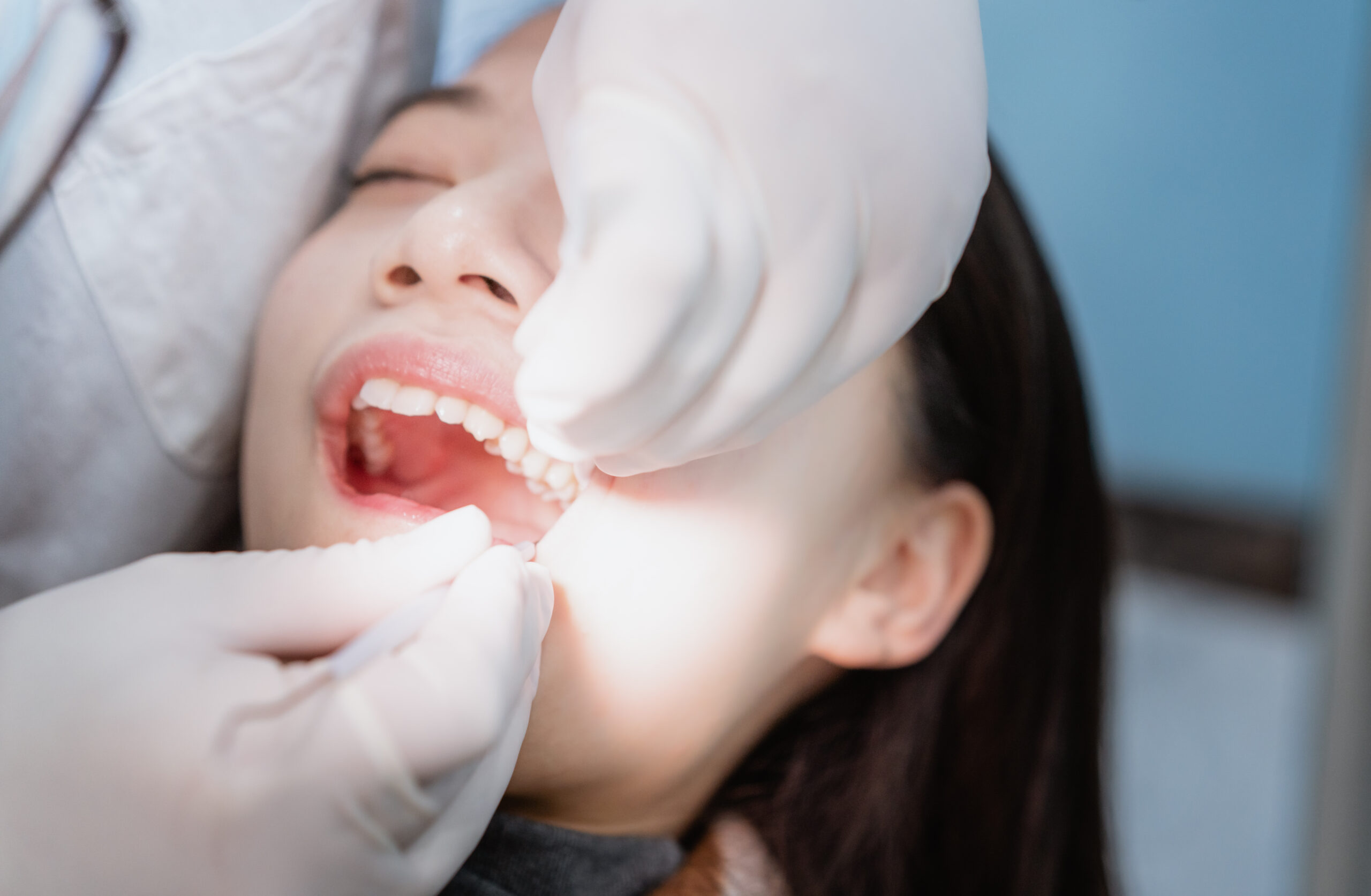 A woman receiving back tooth treatment