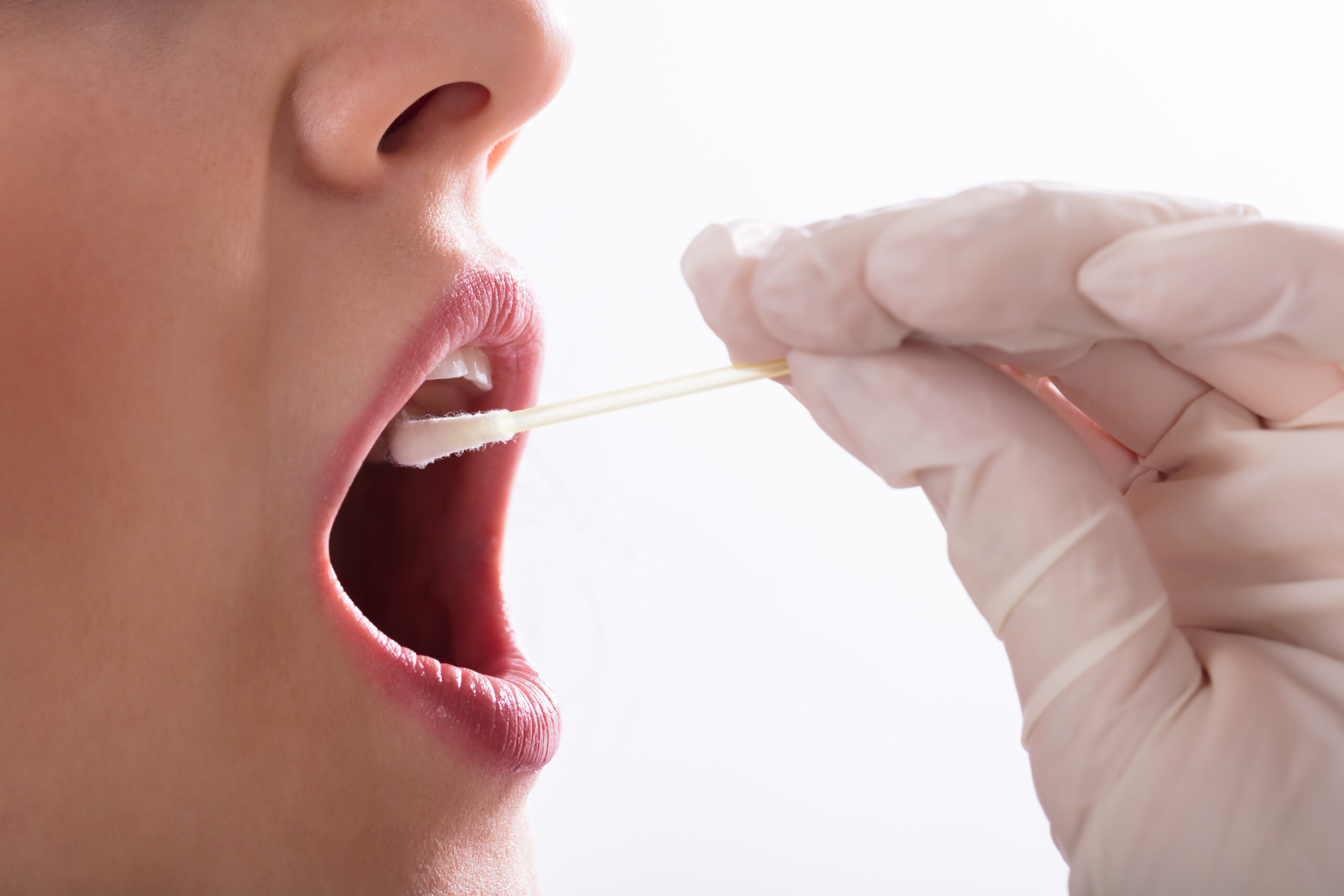 Dentist's Hand Taking Saliva Test From Woman's Mouth With Cotton Swab