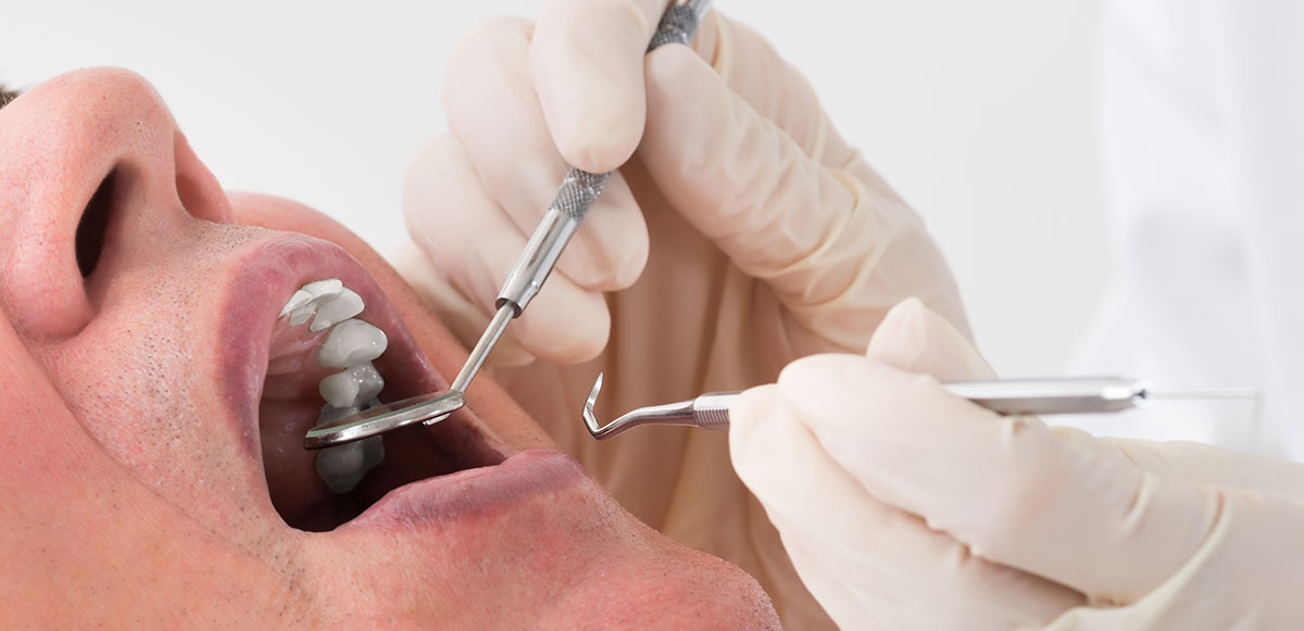 京橋歯科医院　必要な検査